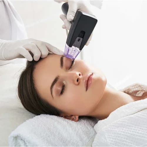 A radiofrequency microneedling handpiece held against a cheek